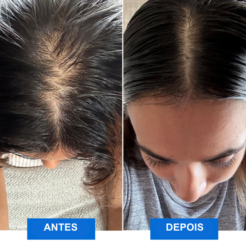 Massageador Capilar e Corporal RelaxSync - Livre-se do Estresse e Restaure seu Cabelo